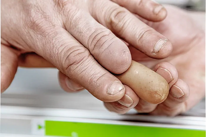 L'artisan Johannes Feldhoff, victime d'une coupure à la main